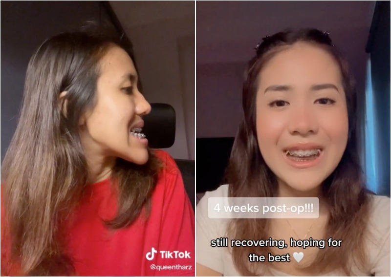 'Scariest thing I've ever gone through' Singapore woman shares 26,000